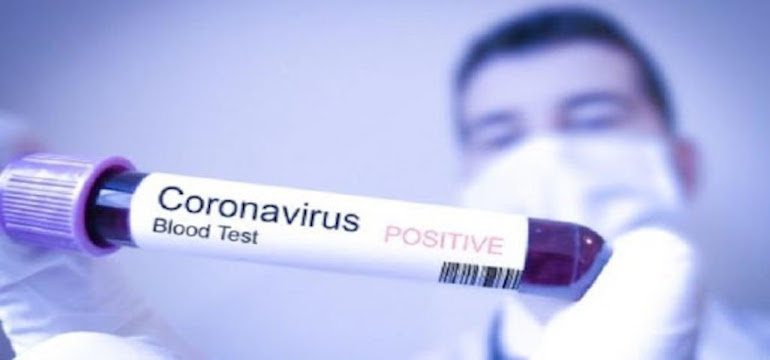 2 Pasien Baru Virus Corona di Indonesia